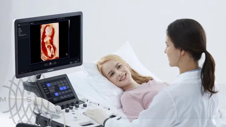 Samsung Medison HS40 УЗИ аппарат (сканер)