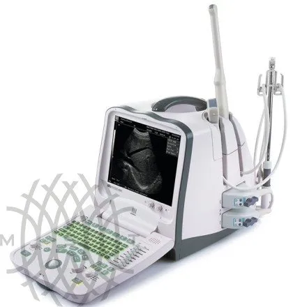 УЗИ аппарат Mindray DP-6900