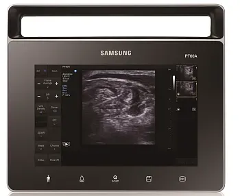 Ультразвуковой аппарат Samsung PT60