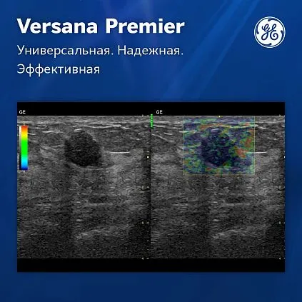 Клинические изображения УЗИ аппарат GE Versana Premier Platinum