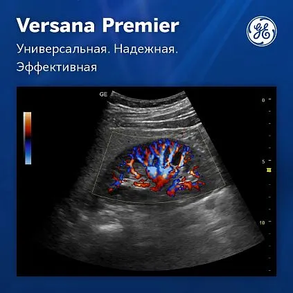 Клинические изображения УЗИ аппарат GE Versana Premier Platinum