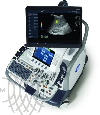 GE Healthcare Logiq E9 XDclear аппарат УЗИ
