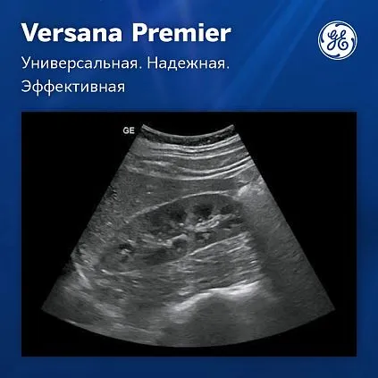 Клинические изображения УЗИ аппарат GE Versana Premier Platinum