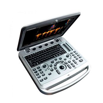 УЗИ аппарат Chison SonoBook 6 портативный