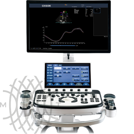 Chison XBit 90 ультразвуковой аппарат