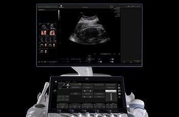 GE HealthCare Voluson Expert 20 УЗИ аппарат