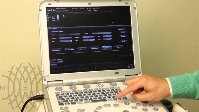 Портативный УЗИ аппарат Mindray M7