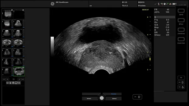 Versana Essential GE Healthcare