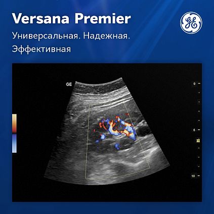 УЗИ аппарат GE Versana Premier Platinum