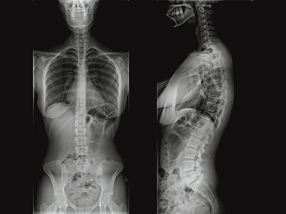 GE Healthcare Optima XR220amx палатный цифровой рентгеновский аппарат 