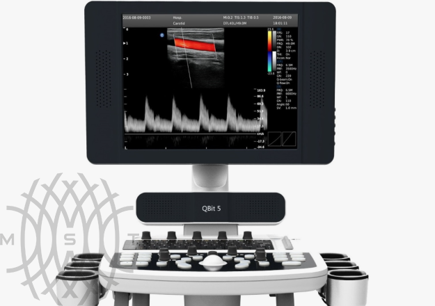 УЗИ аппарат Chison Qbit 5