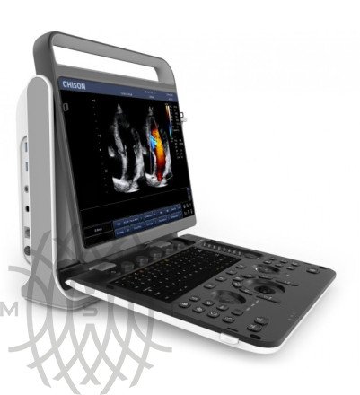 УЗИ аппарат Chison Sonotouch 60 OB портативный