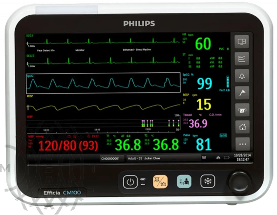 Монитор пациента Philips Efficia CM100